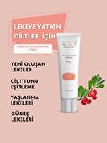 ACLIND® ANTI-BLEMISH CREAM 30 ml | Leke Karşıtı Krem | Güzellik Serisi