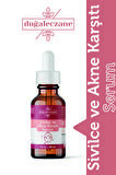 Sivilce Akne Karşıtı Serum 30 ml