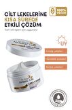 Tüm Cilt Tipleri İçin Leke Karşıtı Leke Krem 50 ml