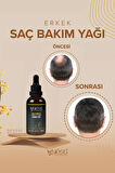 Wyess Erkekler Özel Saç Bakım Yağı Yeni Saç Teli Çıkaran E Vitaminli 30 Yağ 50 ml