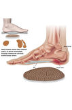 LT04 - Deri Pençe Destek | Numara Küçültme, Ayakkabı Daraltma, Koku Önleyici ve Ter Emici Ayak Pedi