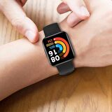 Zore Xiaomi Redmi Watch 2 Lite Uyumlu Klasik Kordon