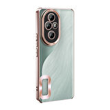 Honor 200 Pro Kılıf Kamera Korumalı Logo Gösteren Zore Omega Kapak -115589