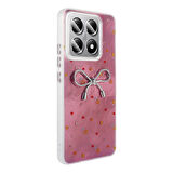 14T Pro Kılıf Kamera Korumalı Figürlü Zore Ponti Silikon Kapak - Açık Pembe