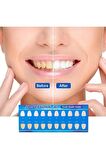 Dr White Diş Beyazlatıcı Kalem 2 ml