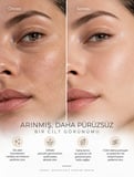 Peeling - Özel Granüllü