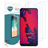 Microsonic Huawei P20 Pro Ekran Koruyucu Nano Cam (3'lü Paket)