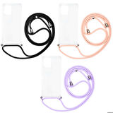 Galaxy A91 (S10 Lite) Uyumlu Zore X-Rop Kapak-Renksiz