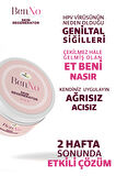 Benno Lezyon Kremi | Et Beni, Genital Siğil, Nasır Ve Siğil Bakım Kremi, 25 ml - Skin Regenerator