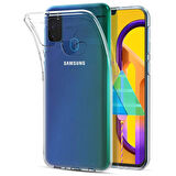 Microsonic Samsung Galaxy M31 Kılıf & Aksesuar Seti