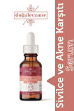 Yoğun Sivilceler için Sivilce Akne Karşıtı Serum 30 ml
