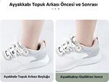 1 Çift Ortopedik Topuk Ekleme Topuklu Spor Ayakkabı Topuk Vurma Önleyici Koruyucu Yastığı Pedi