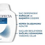 ALOPECİA ANTİDANDRUF(KEPEK) ŞAMPUAN 300 ML