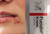 Fucidin Krem 20 gr.