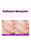 Hyalusteen Repair Emulsion Cilt Nemlendirici Onarıcı Ve Yenileyici Emülsiyon Krem Kore 120ml