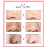 6 Başlıklı Vakumlu Siyah Nokta Temizleyici