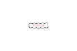 Corteco 023680P Üst Kapak Conta Ducato Boxer 2.8 Düz X MRMOEM-1065745