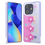 Tecno Tekno Spark 10 Pro Kılıf Parlayan Simli Kabartma Figürlü Cevze Kapak