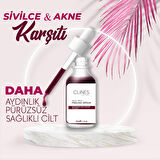 Clines Red Peeling Akne ve Leke Serumu 30 ML