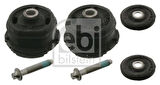 Febi 14899 Travers Tamir Takımı Arka Ön Taraf E-Serisi W210 95-00 S210 96-02 2103505808
