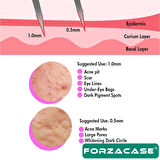 Forzacase Dermaroller 0.5 mm 540 İğneli Masaj Aleti Saç Skin Cilt Tarağı  - FC837
