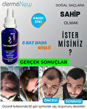 Saç Losyonu Saç Bakım Yağı - saç gürleştirici - saç yağı lotion / 5 Adet Serum