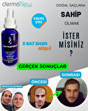 DERMANEW HAİR Sac Bakım Yağı - Saç Gürleştirici - Serum - Saç Yağı - Hair ( 5 Serum + Roller )