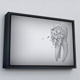 Altın Çerçeveli Diş Kliniği Duvar Tablosu, Çürüyen Diş, Diş Hekimi Tablo