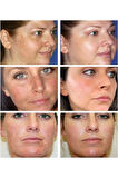 Kanza Beyazlatıcı Krem + Sabun Ve Serum Seti 3'lü Set