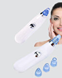 Siyah Nokta ve Gözenek Temizleyici Vakumlu Cihaz – Masajlı Derin Temizlik Teknol