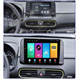HYUNDAİ KONA 2019-2023 UYUMLU 10 inç 6-128 GB MULTİMEDYA