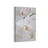 Olla 11723D Orkide Çiçek Görseli Dikey Kanvas Tablo (Ölçü: 70X105)