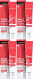 Neutrogena Spot Controlling Sivilce Karşıtı Serum 30ML (4 Lü Set)