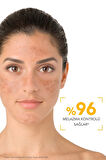 Bioderma Photoderm M Light SPF50+ 40 ml 2 Adet