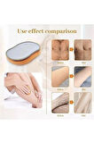TİNEKE Crystal Eraser Epilasyon Aleti Tüy Silgisi Tüy Alıcı Fiziksel Kristal Epilatör