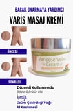 Var.is Bölgesi Için Bacak Onarmaya Yardımcı Ve Besleyici Varicose Masaj Kremi 100 ml
