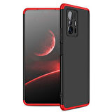 Xiaomi Mi 11T Pro 5G Kılıf 3 Parça Slim Sert Silikon Kapak AYS