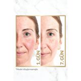 Avon Anew Renewal Power Serum 10 ml