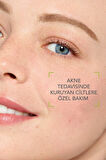 HYDRA INTENSİVE CERAMİDE CONTAİNİNG DRYİNG ACNE TREATMENT SOOTHİNG CARE CREAM 40 ML GKÜRN936