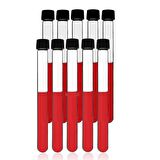 Cam Deney Tüpü 16x160 mm - 20 Adetlik Set - Hacim: 21ml - Isıya Dayanıklı