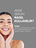 Akne Serum