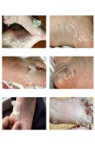 Ayak Peeling Maskesi – Nasır, Ölü Deri, Giderici, Nemlendirici Lavanta Özlü Maske