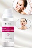 AKNE VE LEKE KARŞITI KREM 50 ML