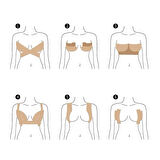 Göğüs Dikleştirme Bandı S Beden 2.5 Cm.