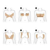 Göğüs Dikleştirme Bandı S Beden 2.5 Cm 5 Mt