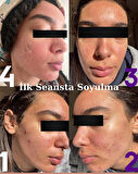 Yosun Peeling 30 Kullanımlık