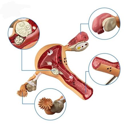 Uterus Pelvik Taban Maketi Model 41