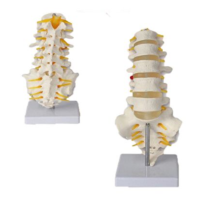 Lomber (Bel) Omurga Maketi Model 19