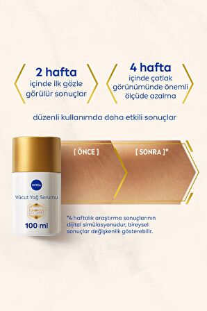 Nivea Luminous630 Çatlak Karşıtı Vücut Yağ Serumu 100ml, Hamilelik, Kilo Değişimi Çatlak Giderici, X2 Adet