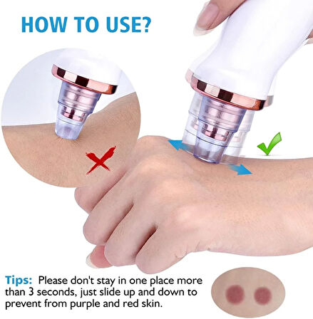 Şarjlı Siyah Nokta Temizleme Cihazı 5 Başlıklı (5224)